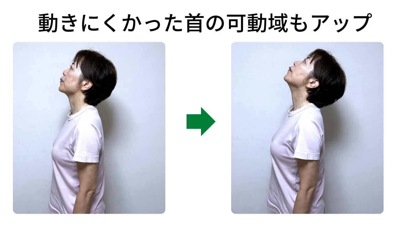スマホやパソコンで慢性的な首の辛さがあっても、神経の働きが向上すれば可動域もアップします!